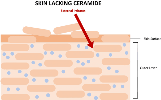 Eczema Skin Needing Ceramides