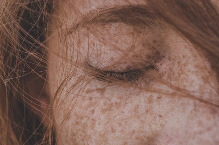 Under-eye Sunscreen Dermatologist Skincare