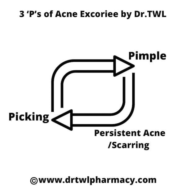 acne excoriee cycle