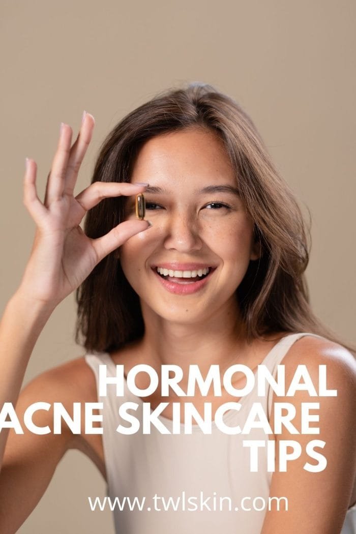 Hormonal Acne Skincare Tips